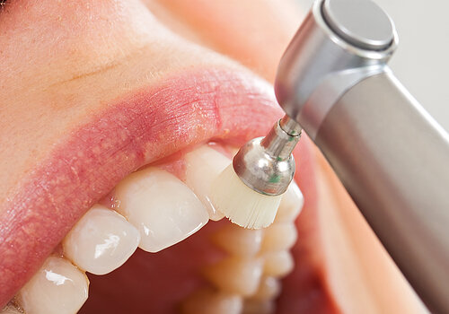 Professional dental cleaning, female patient's beautiful denture